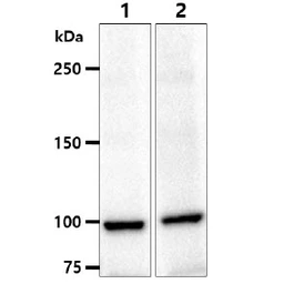 Anti-alpha Actinin 1 antibody [AT1D10] used in Western Blot (WB). GTX57633