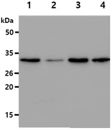 Anti-GSTT2 antibody [AT10H4] used in Western Blot (WB). GTX57646