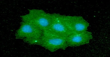 Anti-IMPA1 antibody [AT2G5] used in Immunocytochemistry/ Immunofluorescence (ICC/IF). GTX57655