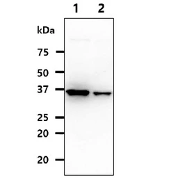 Anti-QPRT antibody [AT24C4] used in Western Blot (WB). GTX57665