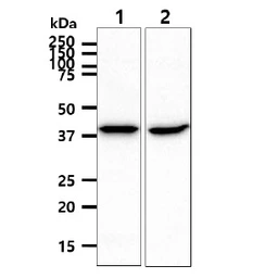 Anti-ACADS antibody [AT8B10] used in Western Blot (WB). GTX57702