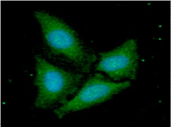 Anti-FIS1 antibody [AT3B7] used in Immunocytochemistry/ Immunofluorescence (ICC/IF). GTX57722