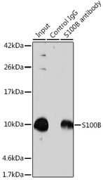 Anti-S100 beta antibody used in Immunoprecipitation (IP). GTX57757