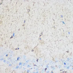 Anti-S100 beta antibody used in IHC (Paraffin sections) (IHC-P). GTX57757