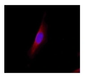 Anti-Lipocalin-2 antibody used in Immunocytochemistry/ Immunofluorescence (ICC/IF). GTX59781