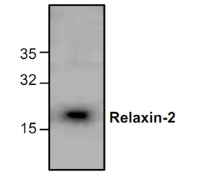 Anti-Relaxin 2 antibody used in Western Blot (WB). GTX59859