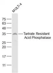 Anti-TRAP antibody used in Western Blot (WB). GTX60167