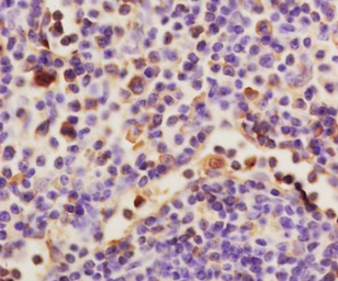 Anti-HAS1 antibody used in IHC (Paraffin sections) (IHC-P). GTX60186