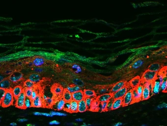 Anti-CXCL16 antibody used in IHC (Paraffin sections) (IHC-P). GTX60199