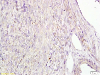 Anti-Alpha fetoprotein / AFP antibody [A2] used in IHC (Paraffin sections) (IHC-P). GTX60214