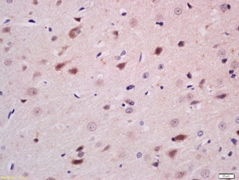 Anti-NGN3 antibody used in IHC (Paraffin sections) (IHC-P). GTX60254