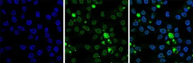 Anti-Histone H2B antibody - ChIP grade used in Immunocytochemistry/ Immunofluorescence (ICC/IF). GTX60346
