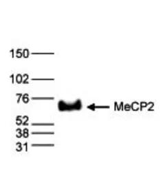 Anti-MECP2 antibody - ChIP grade used in Western Blot (WB). GTX60358