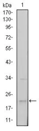 Anti-SNAI1 antibody [6D2] used in Western Blot (WB). GTX60382