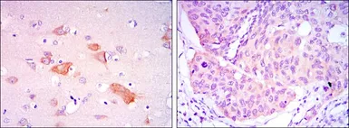 Anti-SMAD5 antibody [3H9] used in IHC (Paraffin sections) (IHC-P). GTX60384