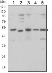 Anti-SMAD5 antibody [3H9] used in Western Blot (WB). GTX60384