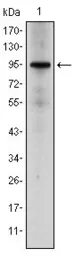 Anti-Glucocorticoid Receptor antibody [6E6] used in Western Blot (WB). GTX60389