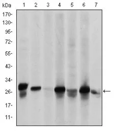 Anti-HSP27 antibody [5D7] used in Western Blot (WB). GTX60444