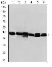 Anti-Cytokeratin 19 antibody [1H6] used in Western Blot (WB). GTX60457
