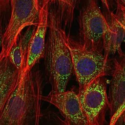 Anti-AIF antibody [4E7] used in Immunocytochemistry/ Immunofluorescence (ICC/IF). GTX60476