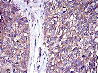 Anti-CBL antibody [3B12] used in IHC (Paraffin sections) (IHC-P). GTX60481