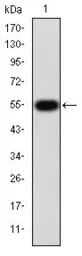 Anti-MMP9 antibody [5G3] used in Western Blot (WB). GTX60482