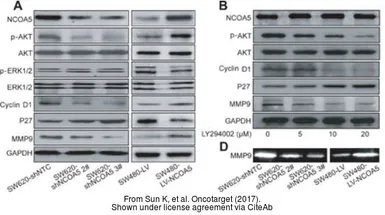 Anti-MMP9 antibody [5G3] used in Western Blot (WB). GTX60482