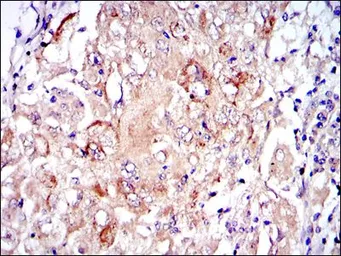 Anti-PKN2 antibody [1D1] used in IHC (Paraffin sections) (IHC-P). GTX60483