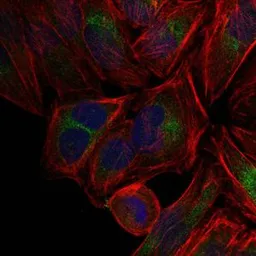 Anti-c-Jun antibody [4H9] used in Immunocytochemistry/ Immunofluorescence (ICC/IF). GTX60485