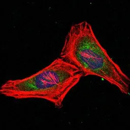 Anti-PSMB8 antibody [1A5] used in Immunocytochemistry/ Immunofluorescence (ICC/IF). GTX60486