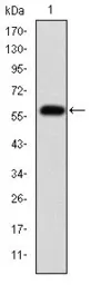 Anti-Fibrinogen gamma antibody [5A6] used in Western Blot (WB). GTX60498