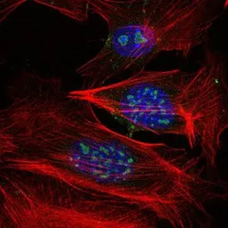 Anti-MEKK2 antibody [4B4] used in Immunocytochemistry/ Immunofluorescence (ICC/IF). GTX60504