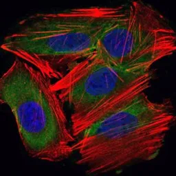 Anti-UBE2I antibody [1B10] used in Immunocytochemistry/ Immunofluorescence (ICC/IF). GTX60512