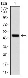 Anti-UBE2I antibody [1B10] used in Western Blot (WB). GTX60512