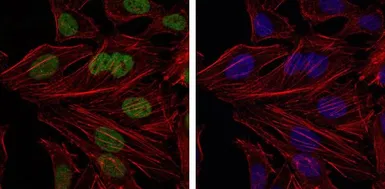 Anti-Bmi1 antibody [3E3] used in Immunocytochemistry/ Immunofluorescence (ICC/IF). GTX60516