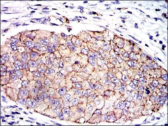 Anti-PAI-1 antibody [1D5] used in IHC (Paraffin sections) (IHC-P). GTX60537