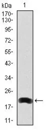Anti-LRP5 antibody [2B11] used in Western Blot (WB). GTX60567