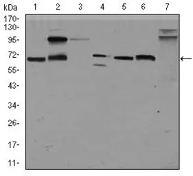 Anti-Glypican-3 antibody [9C2] used in Western Blot (WB). GTX60603