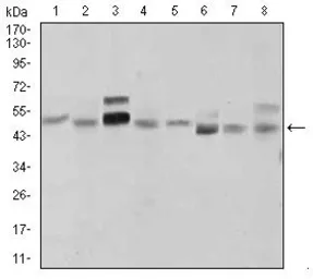 Anti-Shh antibody [5H4] used in Western Blot (WB). GTX60606