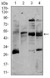 Anti-CD5 antibody [6A11] used in Western Blot (WB). GTX60631