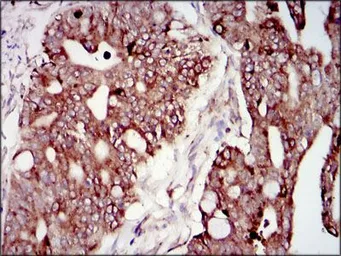 Anti-PI3 kinase p85 alpha antibody [6G10] used in IHC (Paraffin sections) (IHC-P). GTX60633