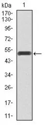 Anti-PI3 kinase p85 alpha antibody [8C11] used in Western Blot (WB). GTX60634