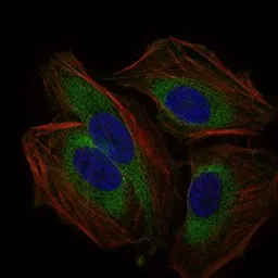 Anti-CD59 antibody [8D2B8] used in Immunocytochemistry/ Immunofluorescence (ICC/IF). GTX60658