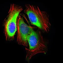 Anti-GLUT4 antibody [3G10A3] used in Immunocytochemistry/ Immunofluorescence (ICC/IF). GTX60674