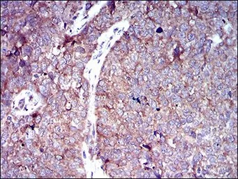 Anti-GLUT4 antibody [3G10A3] used in IHC (Paraffin sections) (IHC-P). GTX60674