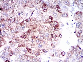 Anti-SLC27A5 antibody [4B11C10] used in IHC (Paraffin sections) (IHC-P). GTX60693