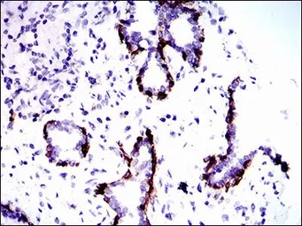 Anti-Cytokeratin 5 antibody [10C11E6] used in IHC (Paraffin sections) (IHC-P). GTX60722