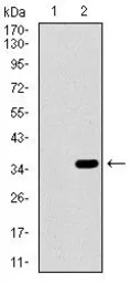 Anti-Alkaline phosphatase (intestinal) antibody [3B10E7] used in Western Blot (WB). GTX60746