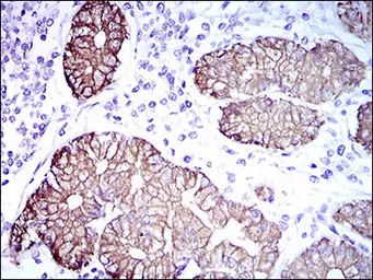 Anti-Cytokeratin 5 antibody [2C2B4] used in IHC (Paraffin sections) (IHC-P). GTX60749