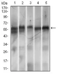 Anti-Ring1 antibody [8C12F4] used in Western Blot (WB). GTX60753